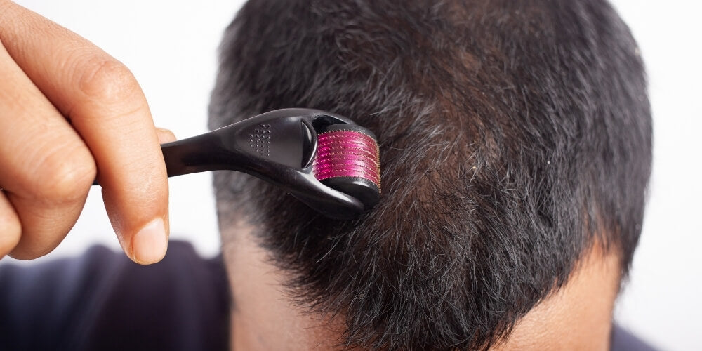 Derma roler za kosu i lice